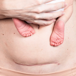 Placenta Accreta Spectrum (PAS) Hands-On